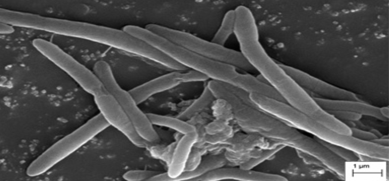 New Genus of Hydrogen-Producing Bacteria Discovered in Maharashtra Hot ...